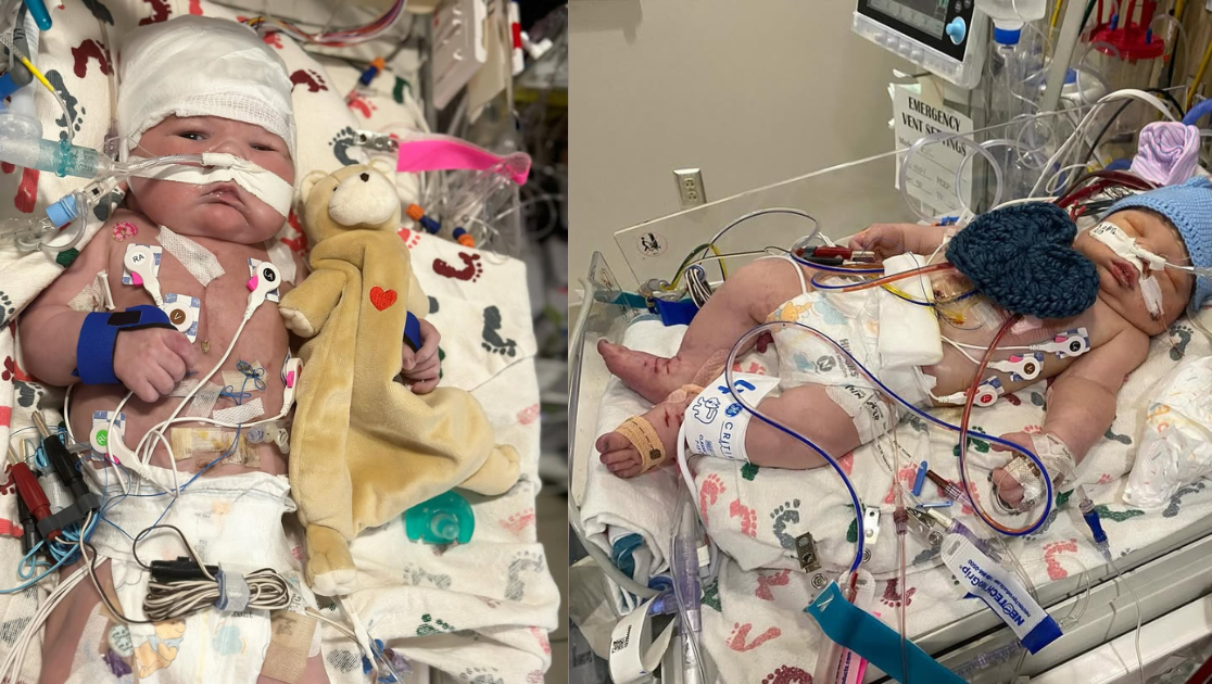 Ajude o Miguel, de apenas 1 aninho, a ter uma chance de viver